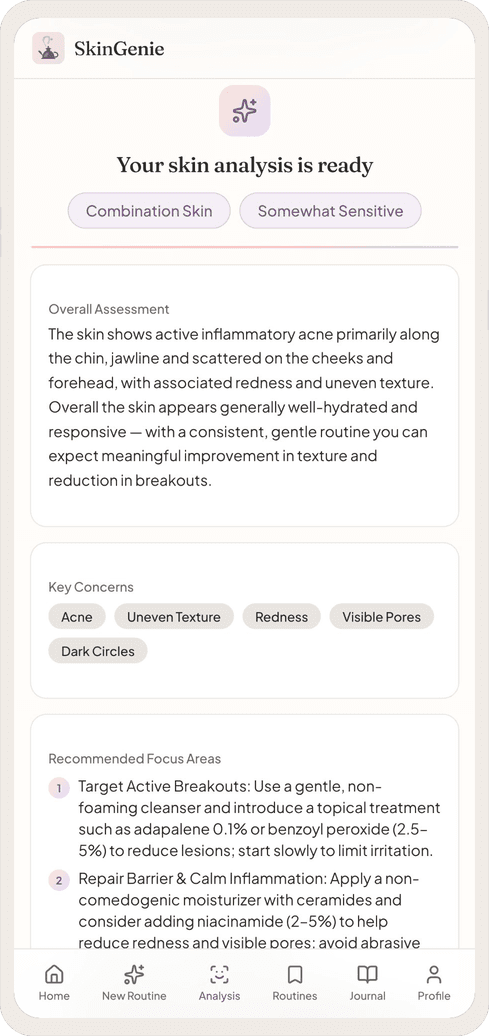 AI skin analysis showing skin type, concerns, and personalized recommendations